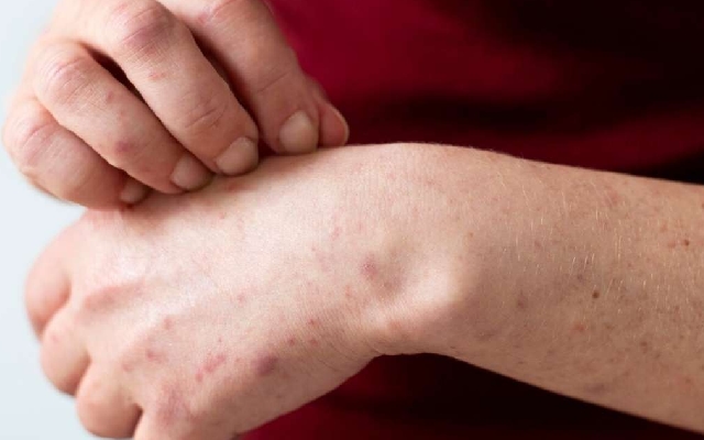 Key Symptoms & Prevention Tips for Liver Health Amid Modern Lifestyle Risks - News Karnataka