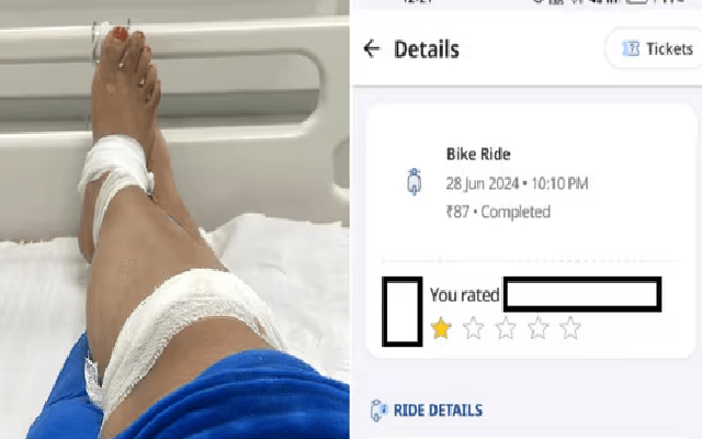 Bengaluru Google Techie Injured by Rash Rapido Driver - News Karnataka