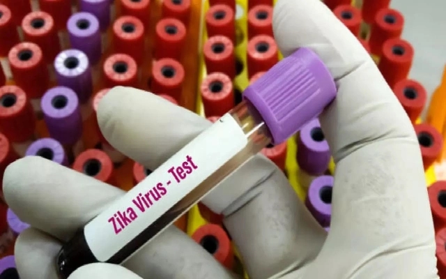 Zika Virus Detected in Bengaluru's Jigani Area - News Karnataka