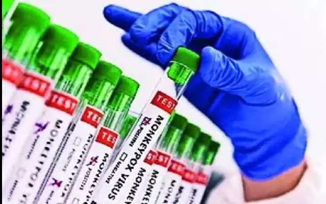 Karnataka Health Department to Focus on Mpox and Zika Virus Preparedness - News Karnataka