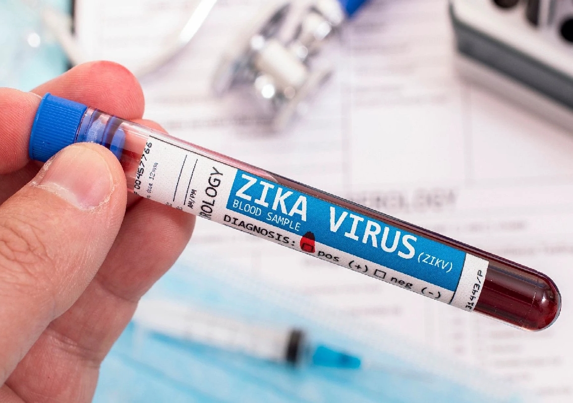 Karnataka Reports First Zika Virus Death as 75-Year-Old Man Succumbs - News Karnataka