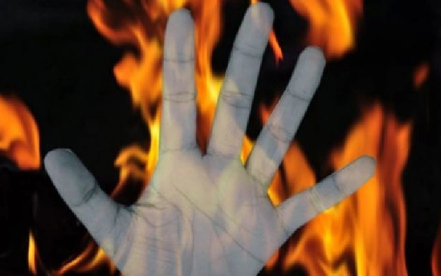 Labourer Killed and Burnt by Friend Over Money Dispute - News Karnataka