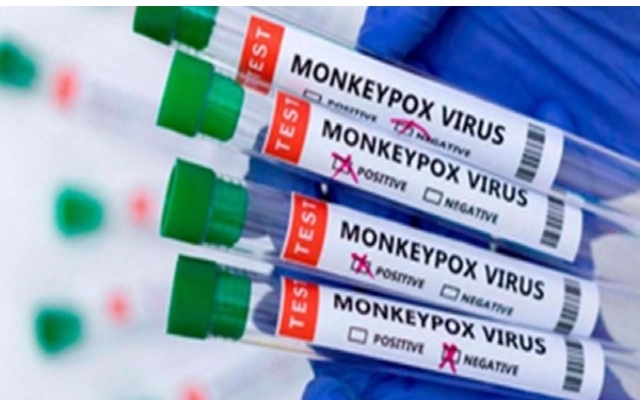 Monkeypox Testing Kiosks Set Up at Bengaluru Airport - News Karnataka