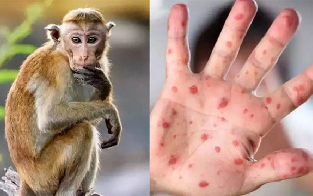Dakshina Kannada Implements Vigilant Measures Against Monkey Fever - News Karnataka