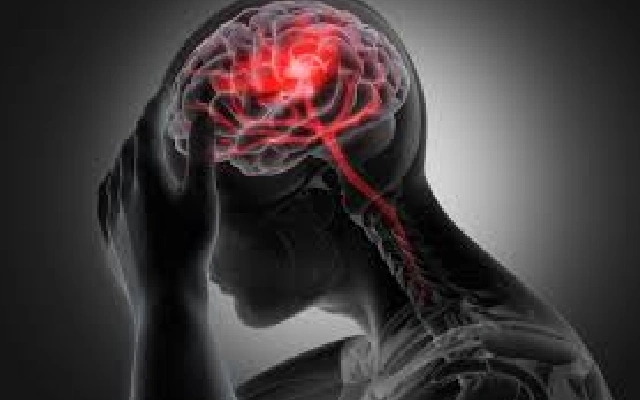 Rising Stroke Cases Among Bengaluru’s Youth Spark Concern - News Karnataka