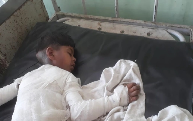 Shivamogga Toddler Tragically Dies from Severe Burns After Tea Spill Incident - News Karnataka