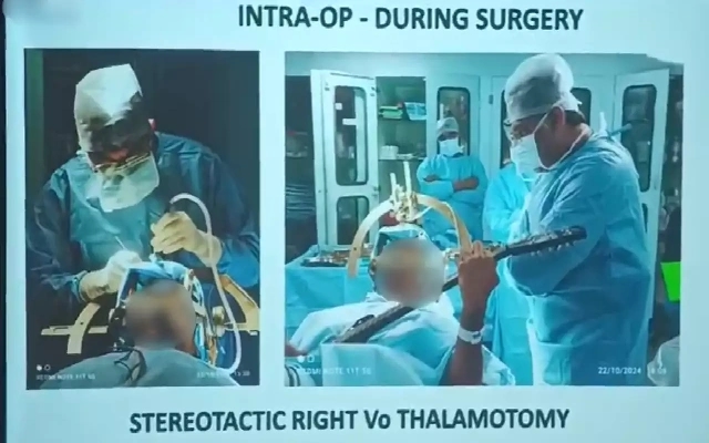 American Music Teacher Plays Guitar During Brain Surgery in Bengaluru - News Karnataka