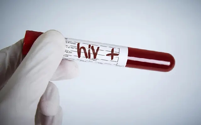 Udupi sees significant decline in HIV/AIDS cases - News Karnataka