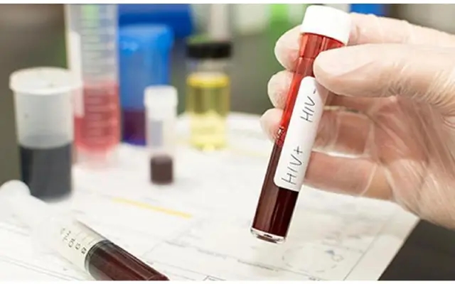 Karnataka sees decline in HIV test positivity rate over a decade - News Karnataka