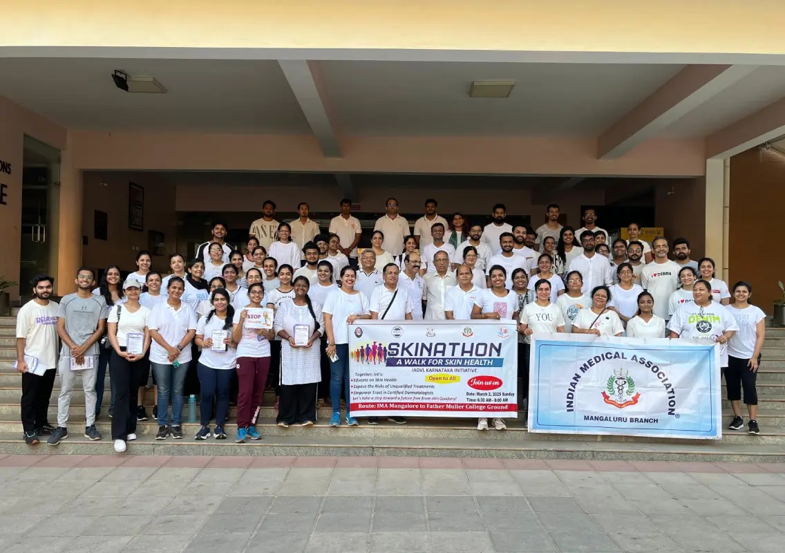 Skinathon walk in Mangaluru raises awareness on skin health and quackery - News Karnataka