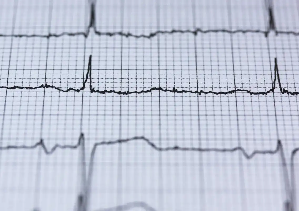 Narayana Health conducts record 11,786 free ECG screenings for women - News Karnataka