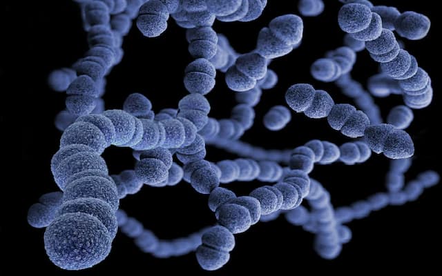 Man’s Tooth Infection Escalates into Life-Threatening Flesh-Eating Disease