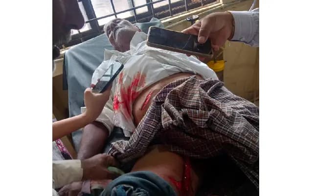 Bidar: Wild Boar Attacks Surge in Forest Minister’s Home District