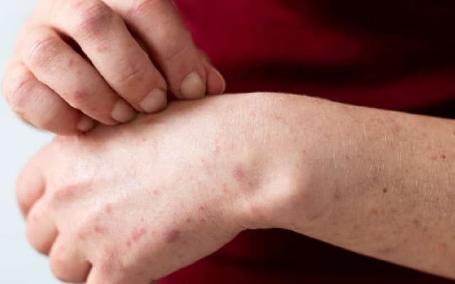 Key Symptoms & Prevention Tips for Liver Health Amid Modern Lifestyle Risks