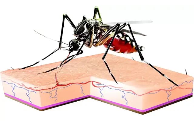 Dengue Concerns in Karnataka: Health Response and Political Debate