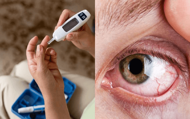 Diabetic Retinopathy: Know symptoms & prevention tips for this eye disease