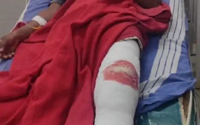 Hoskote: Police Shoot and Arrest Drug Peddler Near City Toll