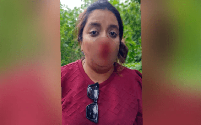 Pune woman ‘punched’ in road rage incident, couple arrested
