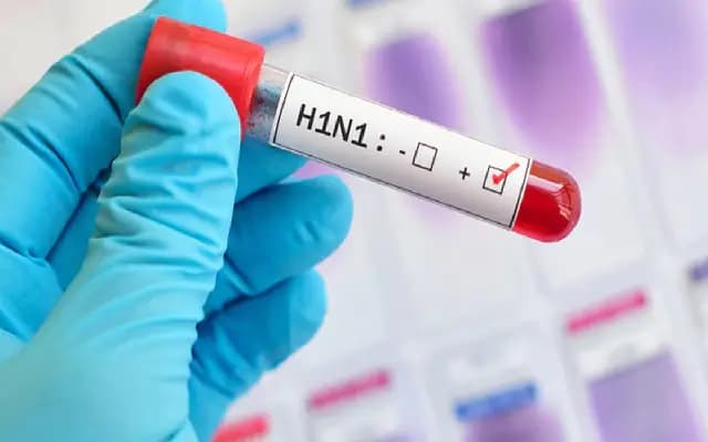 Ernakulam Reports 11 Confirmed H1N1 Cases, Urges Immediate Medical Attention