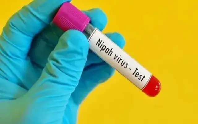 Dakshina Kannada Health Department on High Alert After Nipah Virus Detection