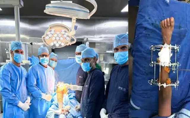 Dr. Satish Nesari Performs Landmark Bilateral Knee Replacement in Karnataka
