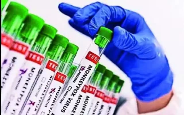 Karnataka Health Department to Focus on Mpox and Zika Virus Preparedness