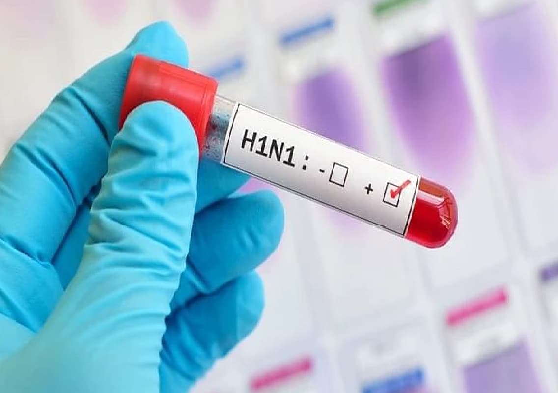 Karnataka Sees Alarming Rise in H1N1 Cases, Sevenfold Increase from Last Year
