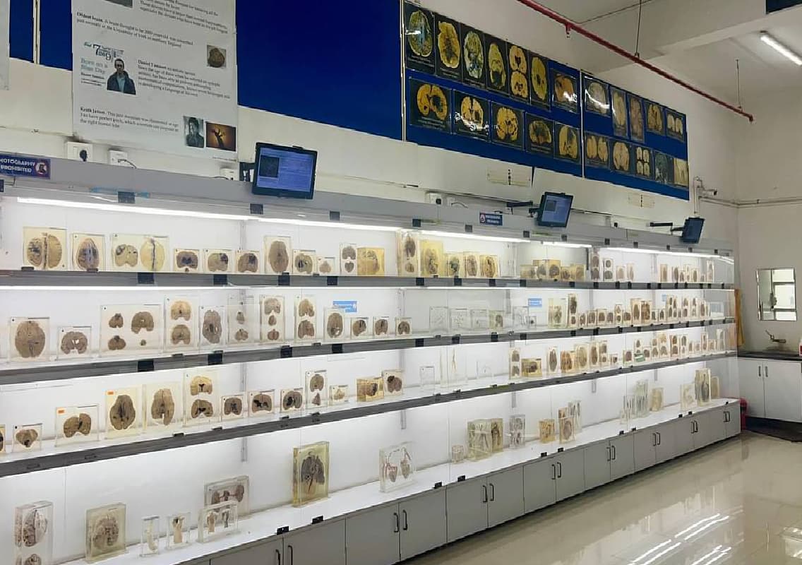 Human Brain Museum at NIMHANS Gains Renewed Popularity After Viral Post
