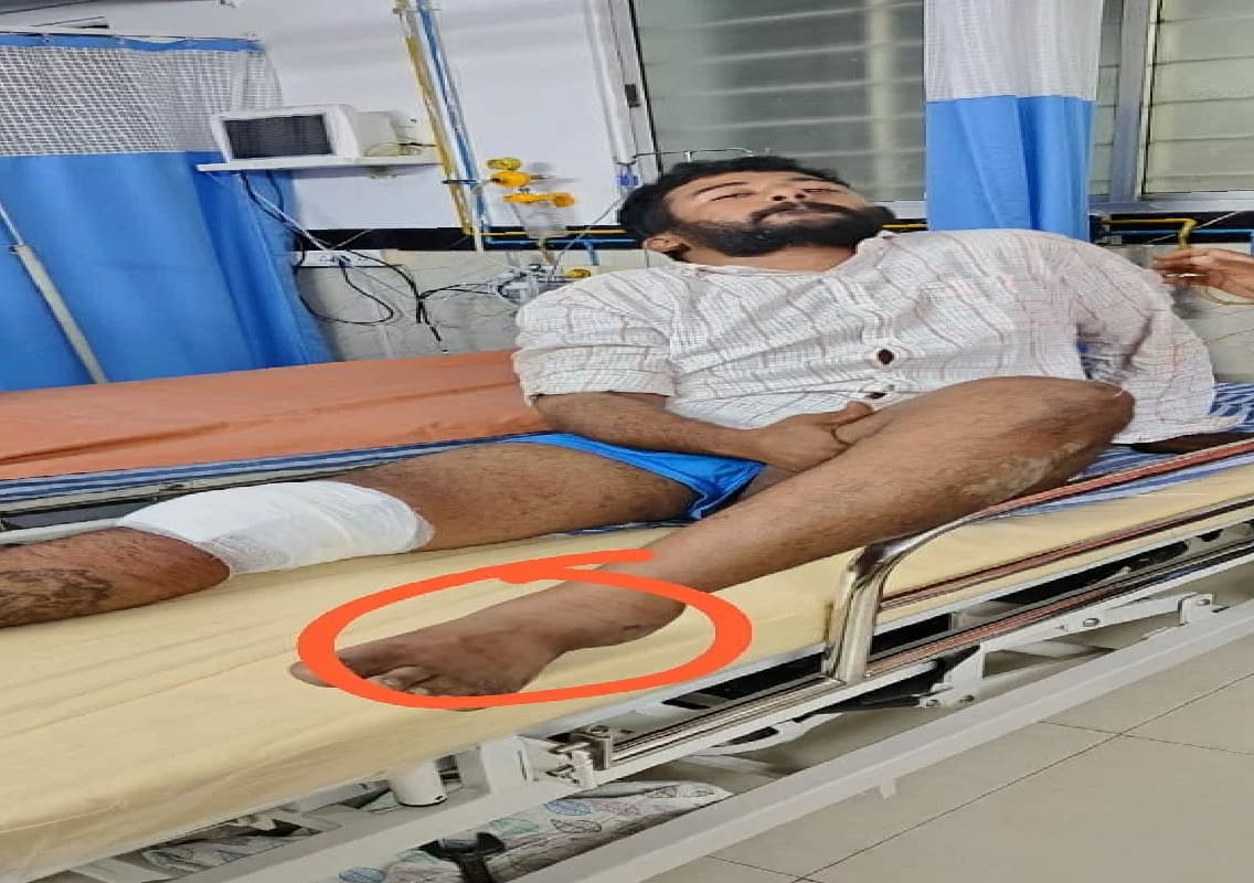 Bengaluru Police Nab Notorious Rowdy Sheeter After Dramatic Confrontation