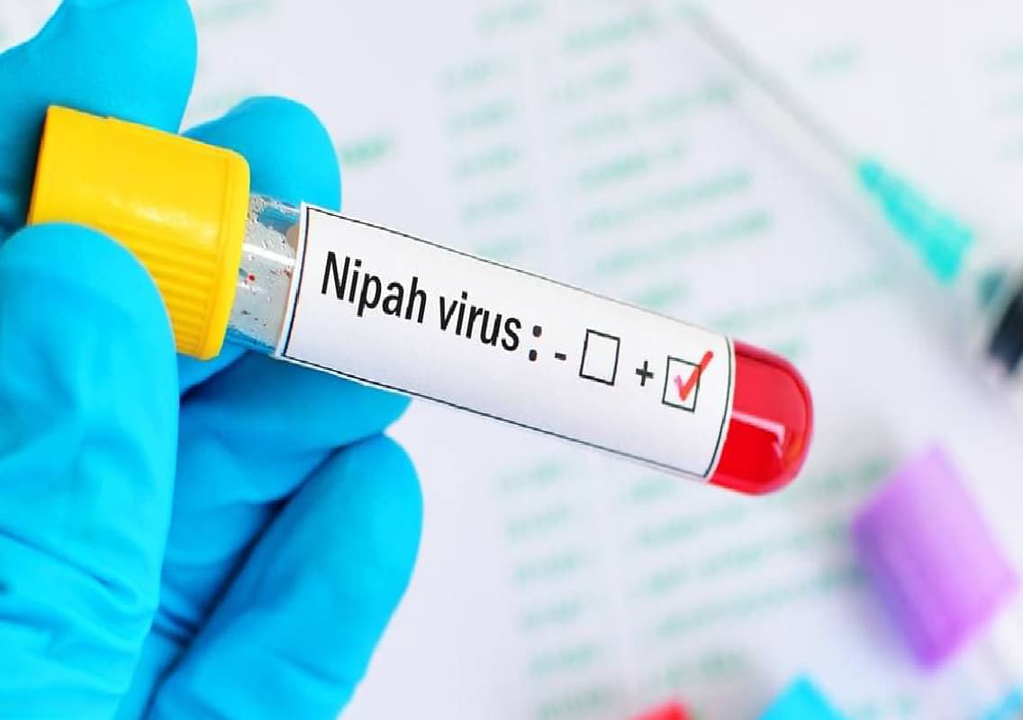 One primary contact of Nipah victim had symptoms, but is stable