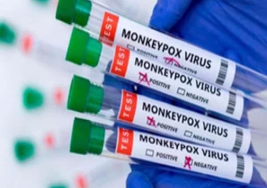 WHO Donates 5,000 Mpox Sample Collection Kits to Uganda