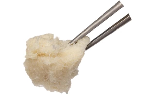 MAHE and Mangalore University Partner for Gamma Irradiation of Bone Allografts