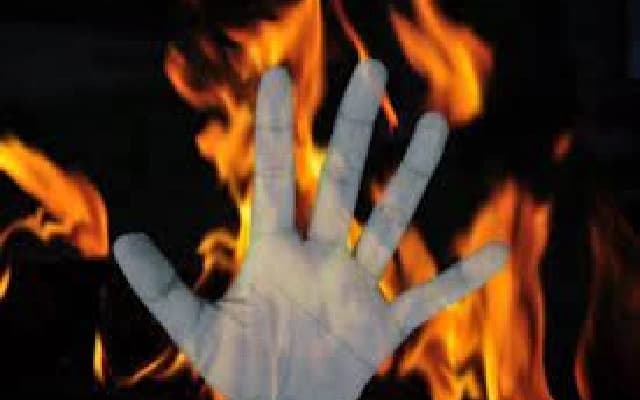 Woman Dies from Burn Injuries After Alleged Attack by Brother-in-Law in Sullia