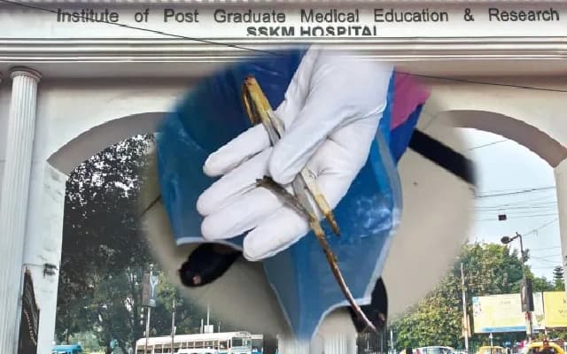 Concern Over Safety Standards After Scissors Break During C-Section in Kolkata Hospital