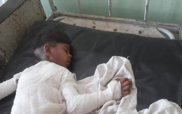 Shivamogga Toddler Tragically Dies from Severe Burns After Tea Spill Incident