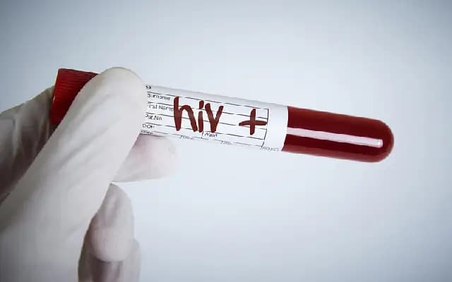 Udupi sees significant decline in HIV/AIDS cases