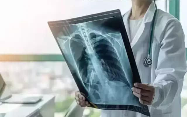 Dakshina Kannada launches 100-day TB elimination campaign