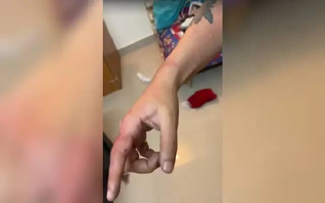 Woman Assaulted and Molested by Landlord’s Brother in Bengaluru