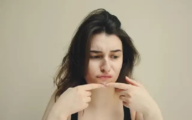 Woman’s pimple turns out to be skin cancer, urges sun safety awareness