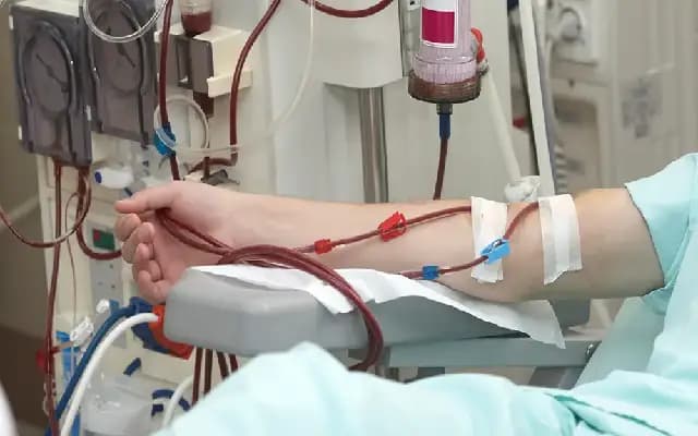 Mysuru Seeks 24 More Dialysis Machines to Meet Growing Demand