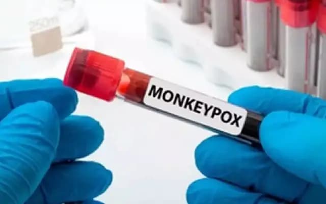Karnataka Expands Free Treatment for Monkeypox to All Families