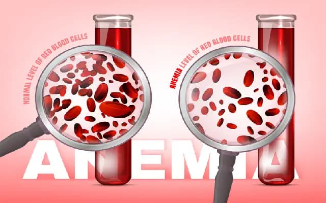 “Mysuru Steps Up to Beat Anaemia in Children and Women”