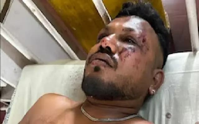 Miracle Survivor Recounts Horror of Ahmedabad Air Crash