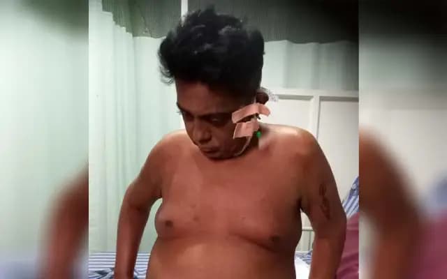 Help Save a Life: Mangaluru Trainer Sandeep Rao Battles Liver Failure