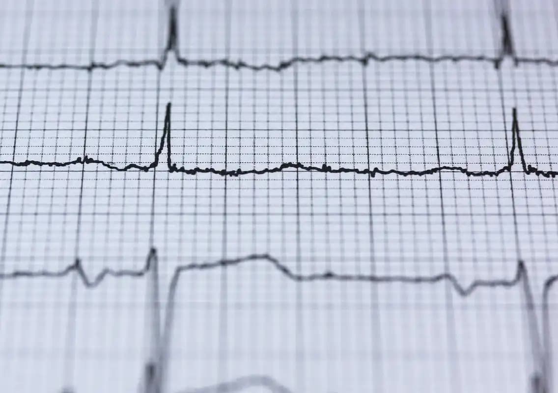 Narayana Health conducts record 11,786 free ECG screenings for women