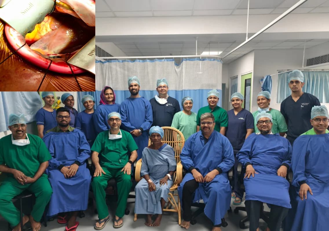 Keyhole heart surgery saves 73-year-old at Yenepoya hospital