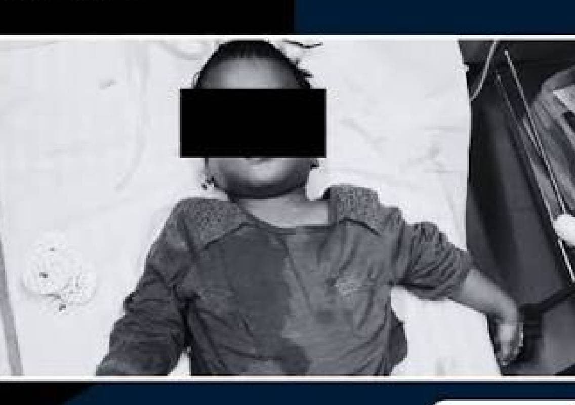 Bengaluru police probe suspicious death of two-year-old