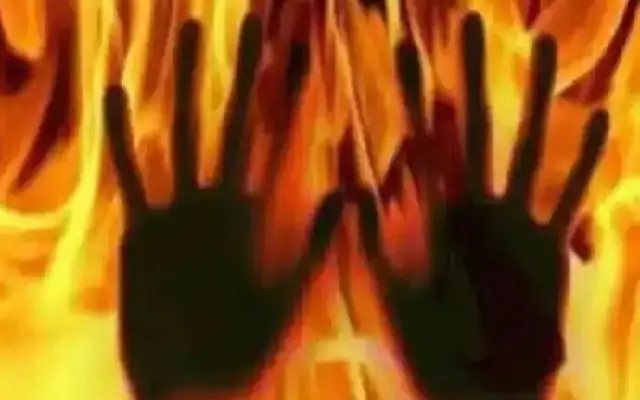 Love Affair Turns Violent: Youth Battling for Life After Being Set on Fire - News Karnataka