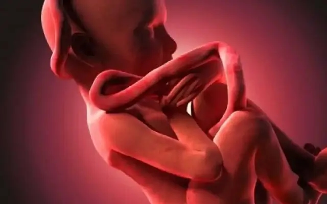 Seven Accused Face Charges of Feticide After Woman's Demise - News Karnataka
