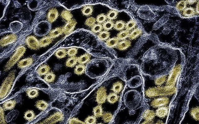 Third Human Case of Bird Flu Detected in US Amid Growing Concerns - News Karnataka